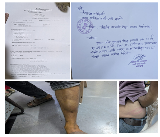 नवी मुंबई के वाशी में फल विक्रेता पर जानलेवा हमला, अमरूद के पैसे मांगने पर विवाद